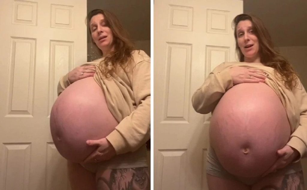 Είναι έγκυος 37 εβδομάδων και η κοιλιά της φτάνει μέχρι το… στήθος (βίντεο)