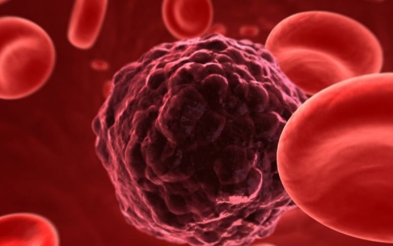 Καρκίνος: Γυναίκα ξεπέρασε 12 όγκους – Τι ανακάλυψαν οι επιστήμονες μελετώντας το αίμα της