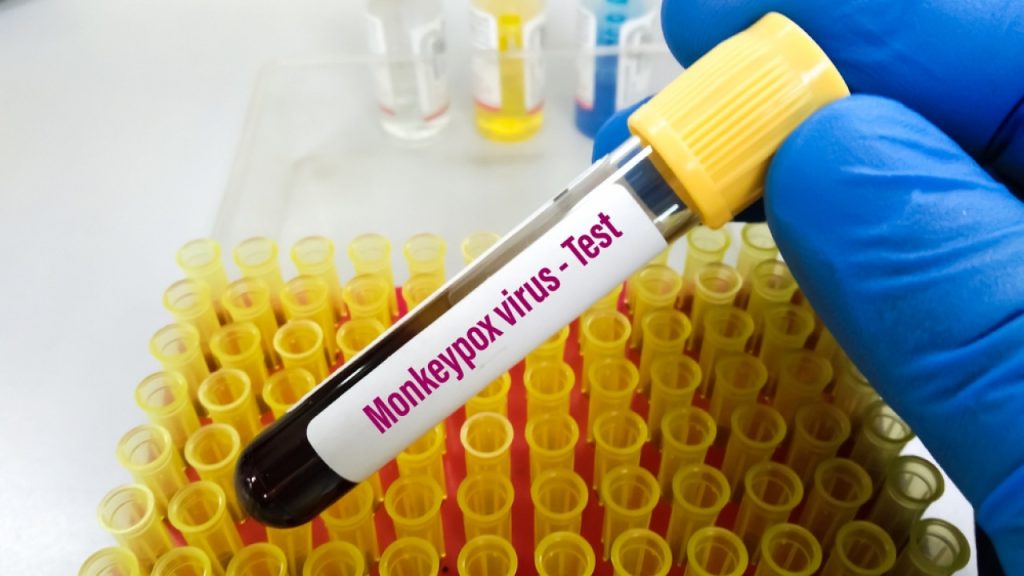 Μελέτη: Η ευλογιά των πιθήκων μεταδίδεται ακόμα και 4 μέρες πριν εμφανιστούν τα συμπτώματα