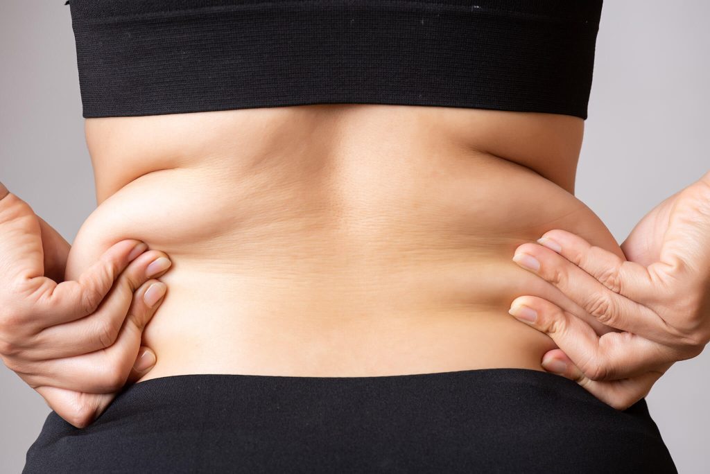 Όσα πρέπει να μάθετε για το λίπος στην κοιλιά: Οι βιολογικοί μηχανισμοί που το προκαλούν – Πώς θα το αποτρέψετε