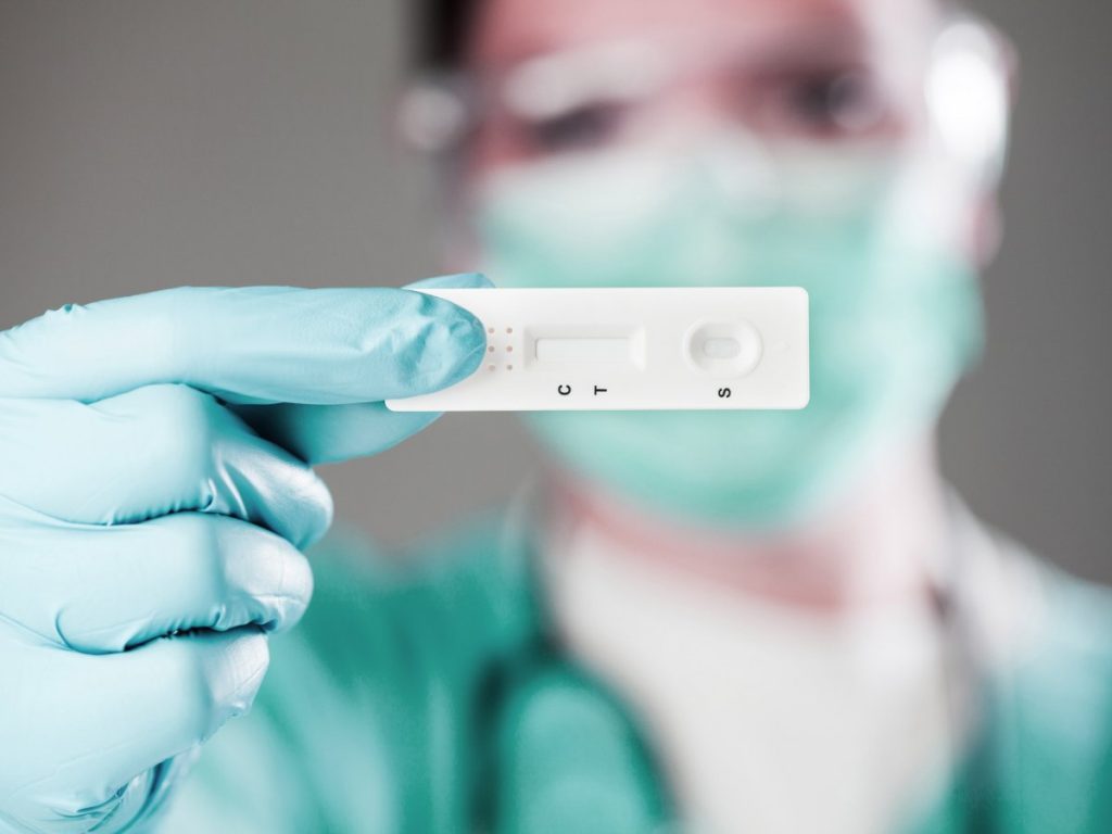 ΕΟΔΥ: Αναλυτικά τα 20 σημεία που μπορείτε να κάνετε αύριο (5/11) δωρεάν rapid test