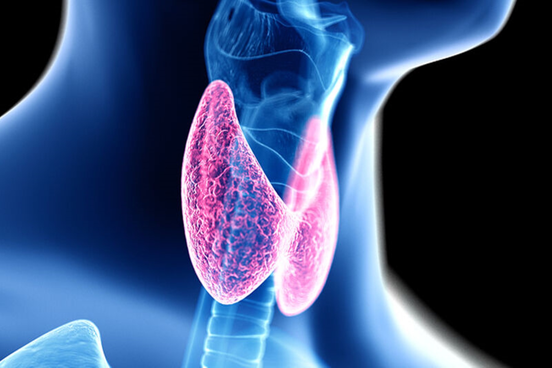 Υποθυρεοειδισμός: Επτά σημάδια υπολειτουργίας του θυρεοειδούς αδένα