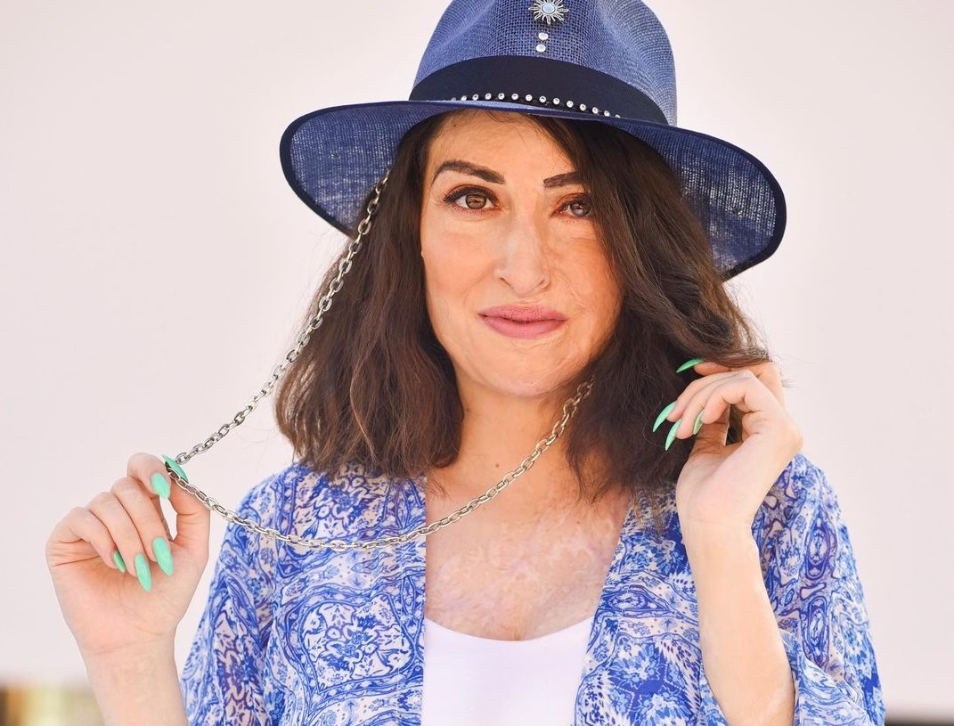 Η Ιωάννα Παλιοσπύρου ανακοίνωσε τη δημιουργία Ιδρύματος από το σημείο που δέχτηκε την επίθεση με βιτριόλι (φωτό)