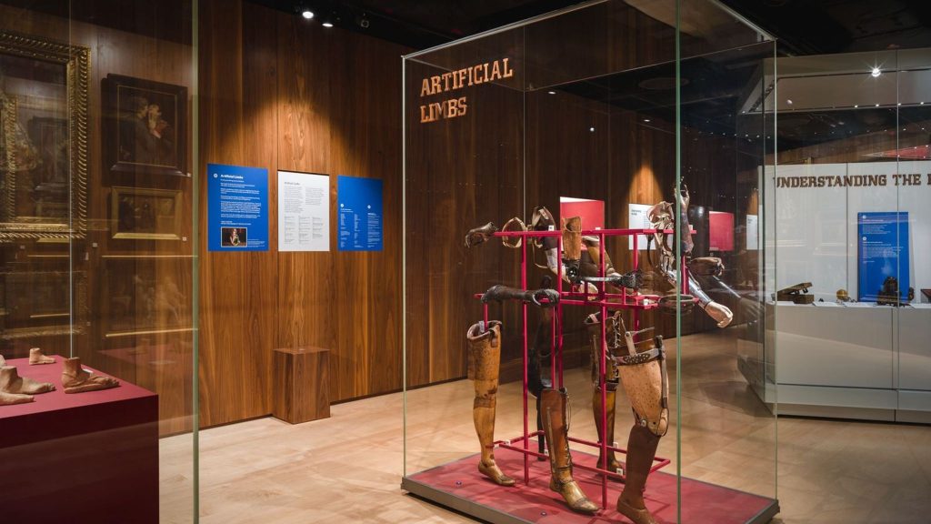 Λονδίνο: Μουσείο αποσύρει «ρατσιστική και σεξιστική» συλλογή για την ιστορία της ιατρικής