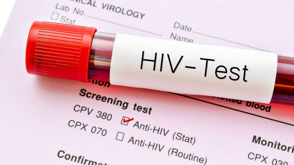 «Έρχεται» Εθνικό Μητρώο ασθενών με HIV και ηλεκτρονική συνταγογράφηση αντιρετροϊκών φαρμάκων