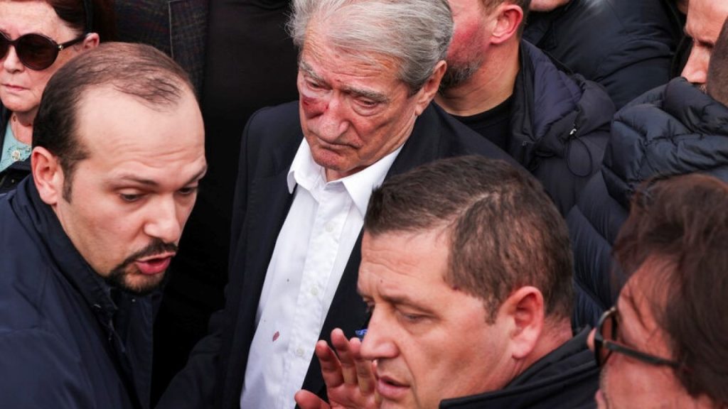 Αλβανία: Περαστικός γρονθοκόπησε στο πρόσωπο τον Σαλί Μπερίσα (βίντεο)