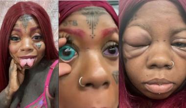 Μητέρα 5 παιδιών έκανε τατουάζ στους βολβούς των ματιών της και τυφλώθηκε – «Η κόρη μου δεν ήθελε να το κάνω» (βίντεο)