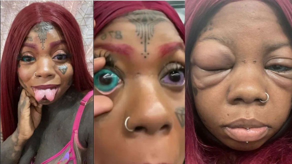 Μητέρα 5 παιδιών έκανε τατουάζ στους βολβούς των ματιών της και τυφλώθηκε – «Η κόρη μου δεν ήθελε να το κάνω» (βίντεο)