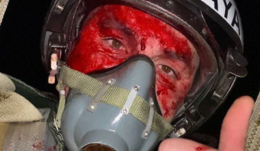 Η ματωμένη selfie του Ουκρανού πιλότου λίγο πριν την εκτίναξη από τo μαχητικό του