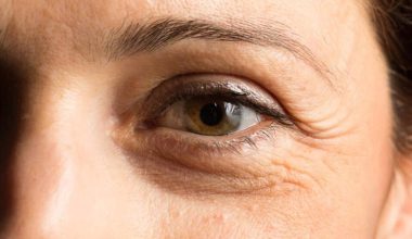 Τρόποι για να μειώσετε τις ρυτίδες κάτω από τα μάτια – Πώς να τις προλάβετε