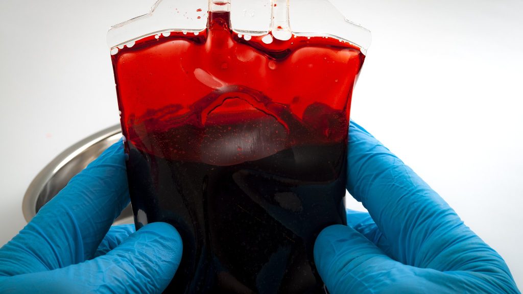 Έχετε αναρωτηθεί; – Αφού το αίμα μας είναι κόκκινο γιατί οι φλέβες μας έχουν μπλε απόχρωση;