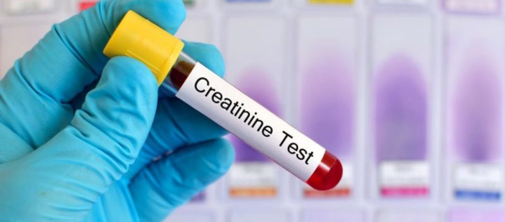 Τι είναι η κρεατινίνη και ποια είναι τα συμπτώματα των υψηλών επιπέδων της