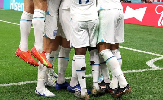 Αυτός είναι ο λόγος που πολλοί ποδοσφαιριστές στο Μουντιάλ έχουν… τρύπες στις κάλτσες τους