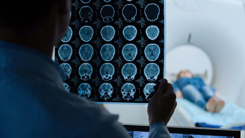 Ασθενής επικοινωνούσε με γιατρό κατά τη διάρκεια χειρουργείου για όγκο στον εγκέφαλο