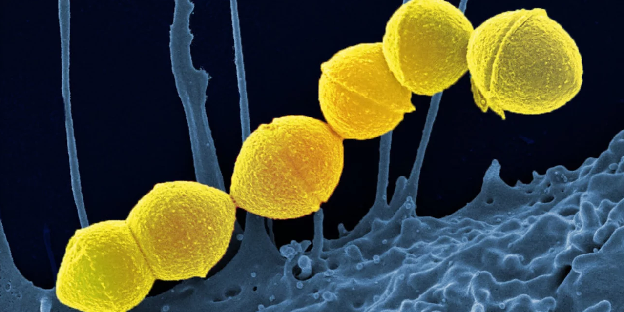 «Καμπανάκι» από τον ΠΟΥ για τον στρεπτόκοκκο Α: Ανησυχία για την εξάπλωσή του στην Ευρώπη