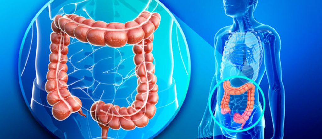 Καρκίνος παχέος εντέρου και πολύποδες: Γιατί είναι σημαντική η εξέταση και ποια τα πρώιμα συμπτώματα