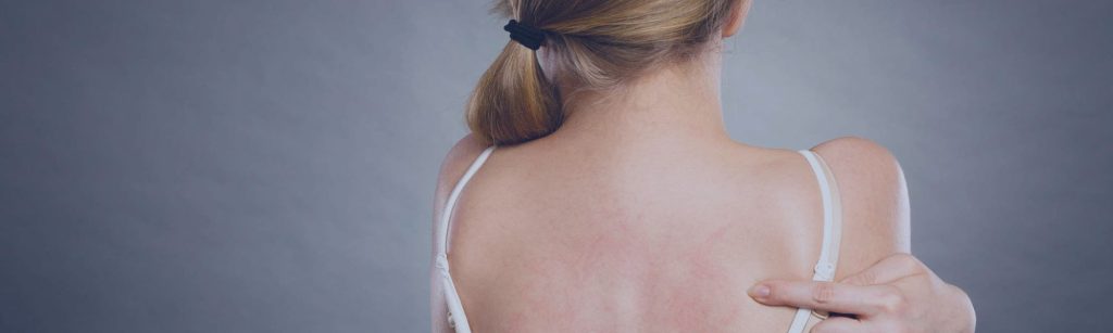 Πώς η ατοπική δερματίτιδα σχετίζεται με τις ημικρανίες