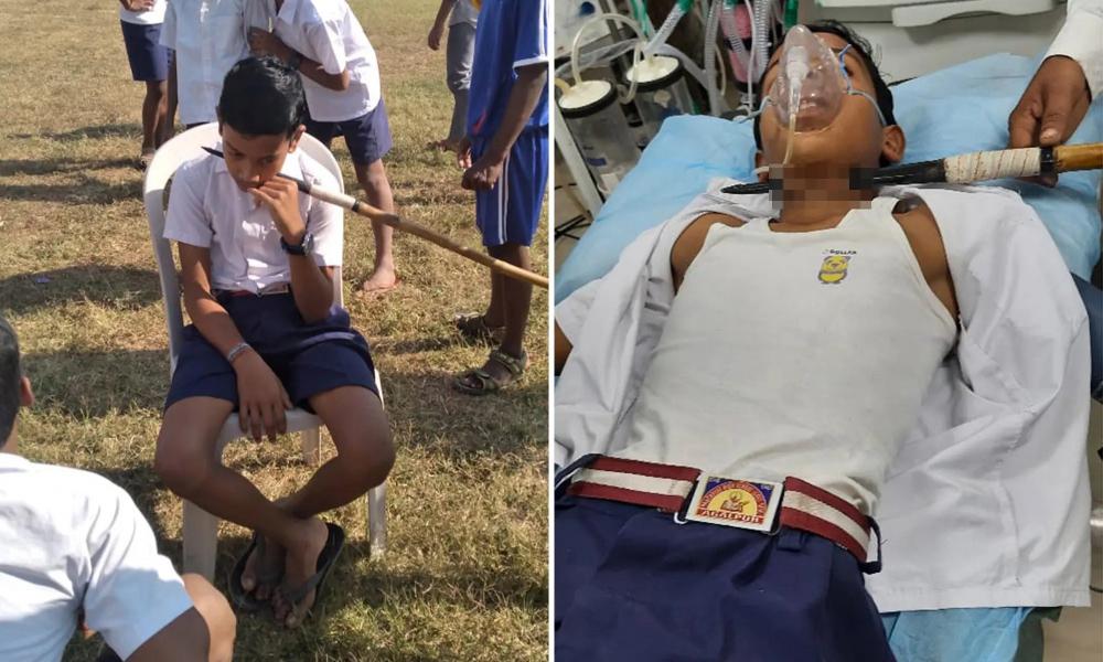 Ινδία: Ακόντιο καρφώθηκε στον λαιμό 14χρονου σε γήπεδο σχολείου (σκληρές εικόνες)