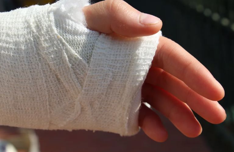 Αγρίνιο: Με συντριπτικό κάταγμα στο χέρι ο μαθητής που ξυλοκοπήθηκε από εξωσχολικούς