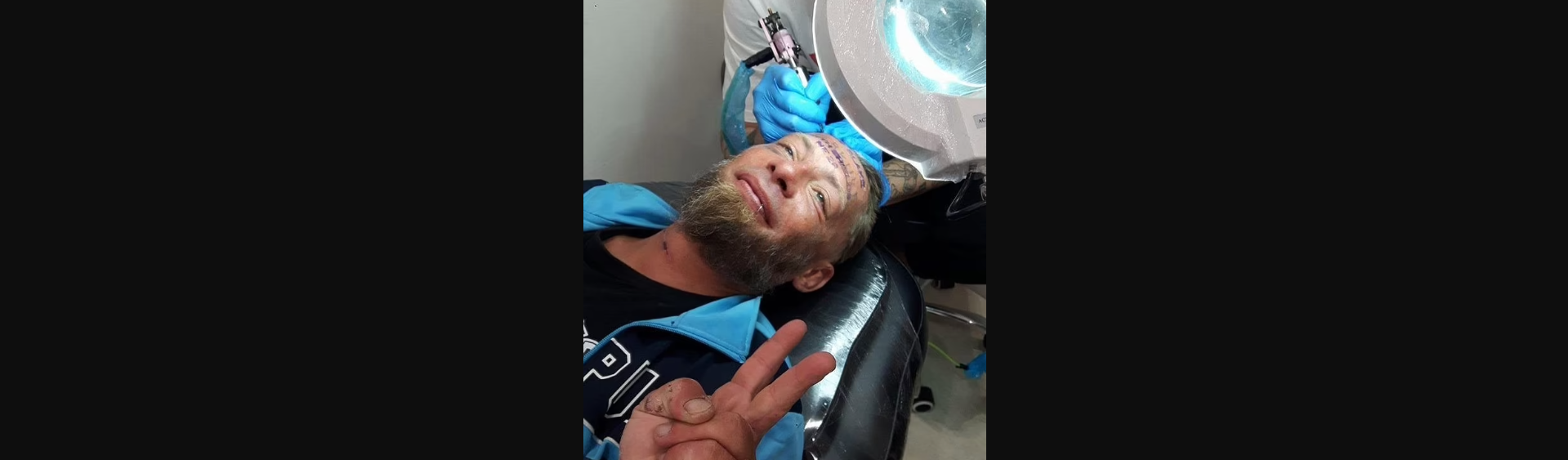 Παρέα που έκανε μπάτσελορ πλήρωσε άστεγο για να κάνει τατουάζ το όνομα του γαμπρού στο μέτωπό του