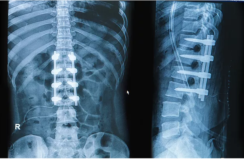 Το γνωρίζατε; – Πόσα οστά έχει ο ανθρώπινος σκελετός;