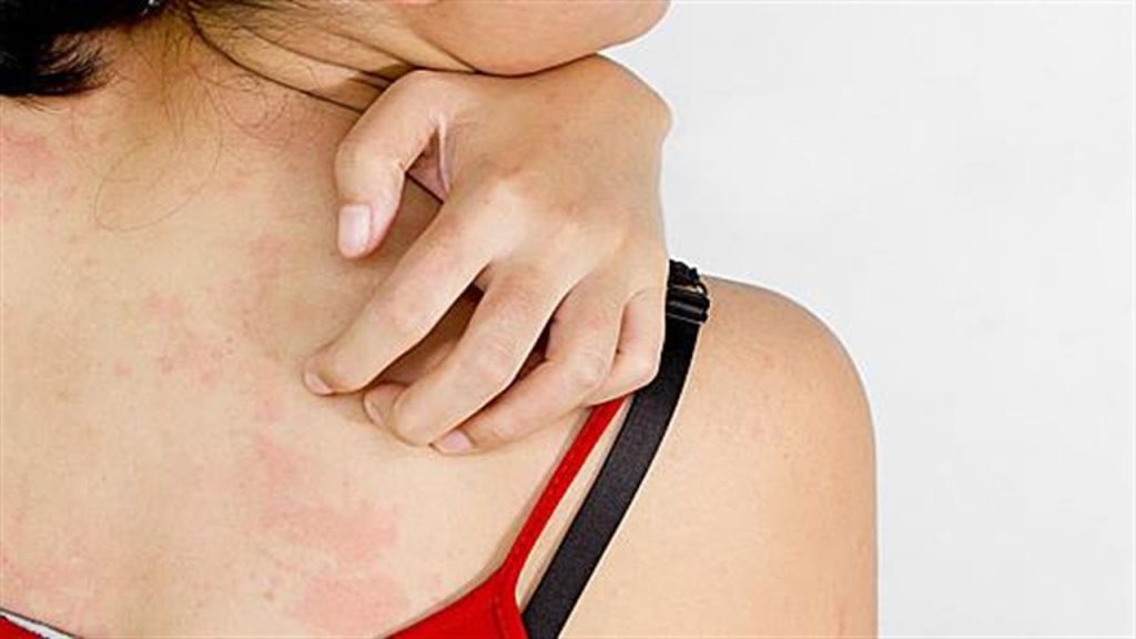 Πώς το δέρμα σου σου αποκαλύπτει πως έχεις χρόνιο στρες;