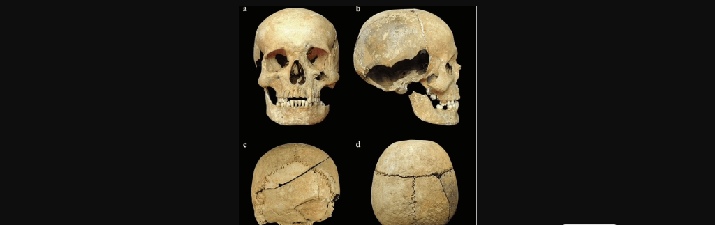 Ιταλία: Επιστήμονες έλυσαν «ανεξιχνίαστη υπόθεση» δολοφονίας 700 ετών! (φωτο)