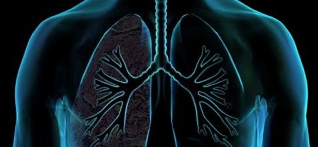 Γήρανση πνευμόνων: Δείτε ποιοι είναι οι βασικοί παράγοντες κινδύνου