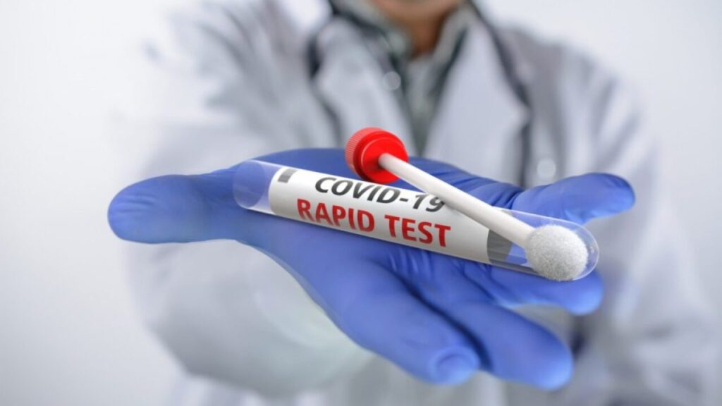 «Τέλος» τα rapid test για τους ανεμβολίαστους εργαζομένους – Τι ανακοίνωσε ο Θ.Πλεύρης