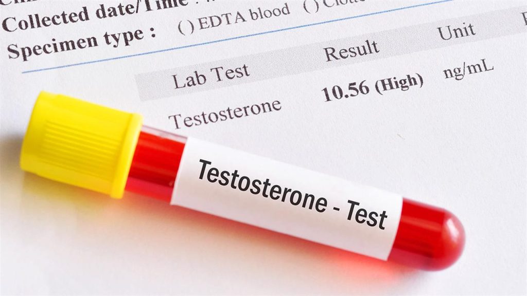 Χαμηλή τεστοστερόνη: Από τι προκαλείται και ποια είναι τα συμπτώματα που σας προειδοποιούν