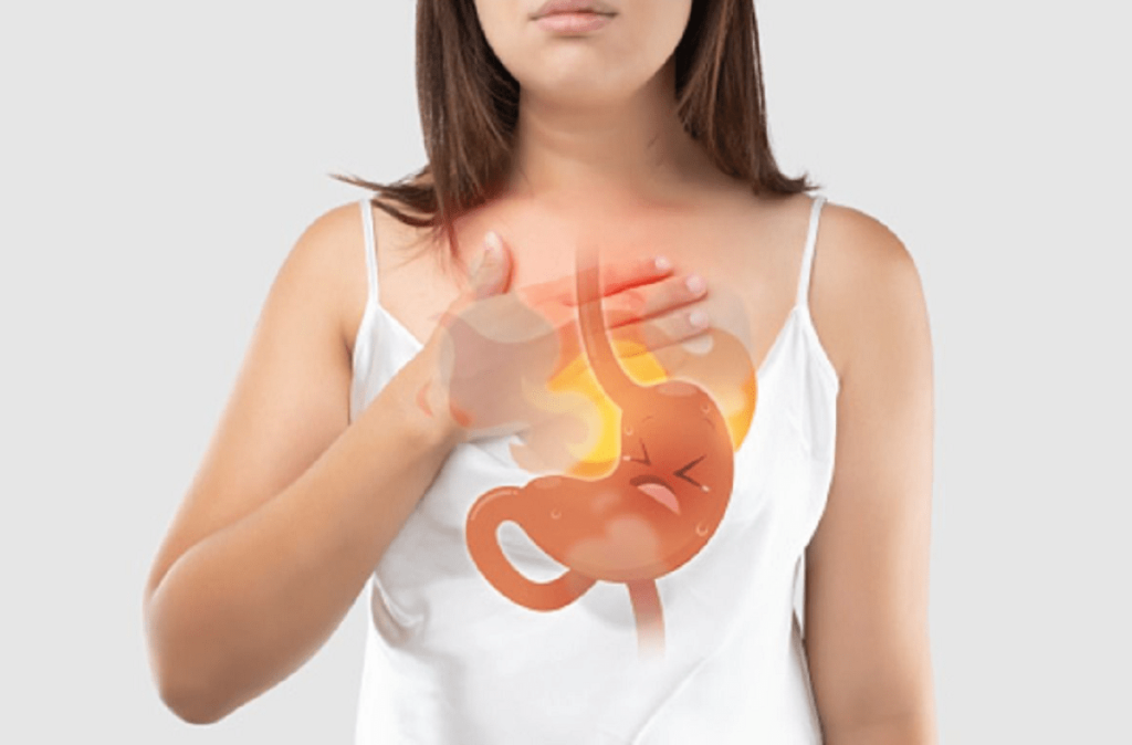 Όσα πρέπει να ξέρετε για τη γαστροοισοφαγική παλινδρόμηση και την καούρα