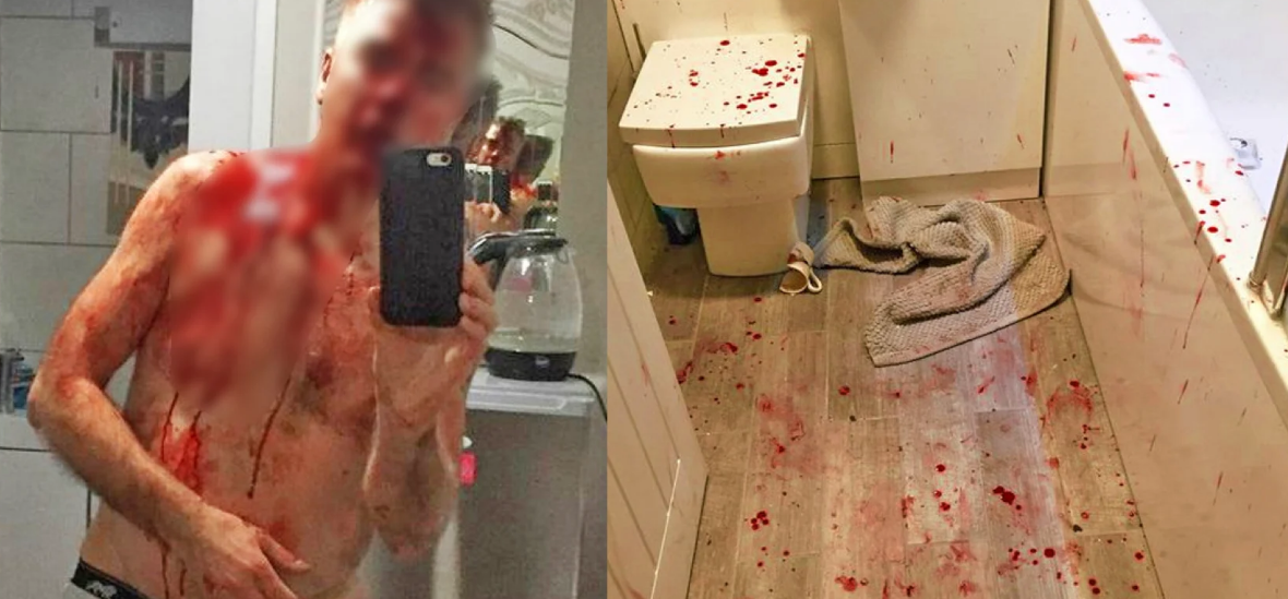 Αγγλία: Ήρωας πατέρας «κομματιάστηκε» από 5 βιαστές με ματσέτες και μαχαίρια αλλά έσωσε την 17χρονη κόρη του! (φώτο) (upd)