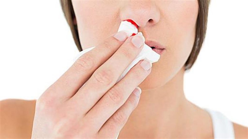 Ρινορραγία: Έξι βήματα για να τη σταματήσετε γρήγορα