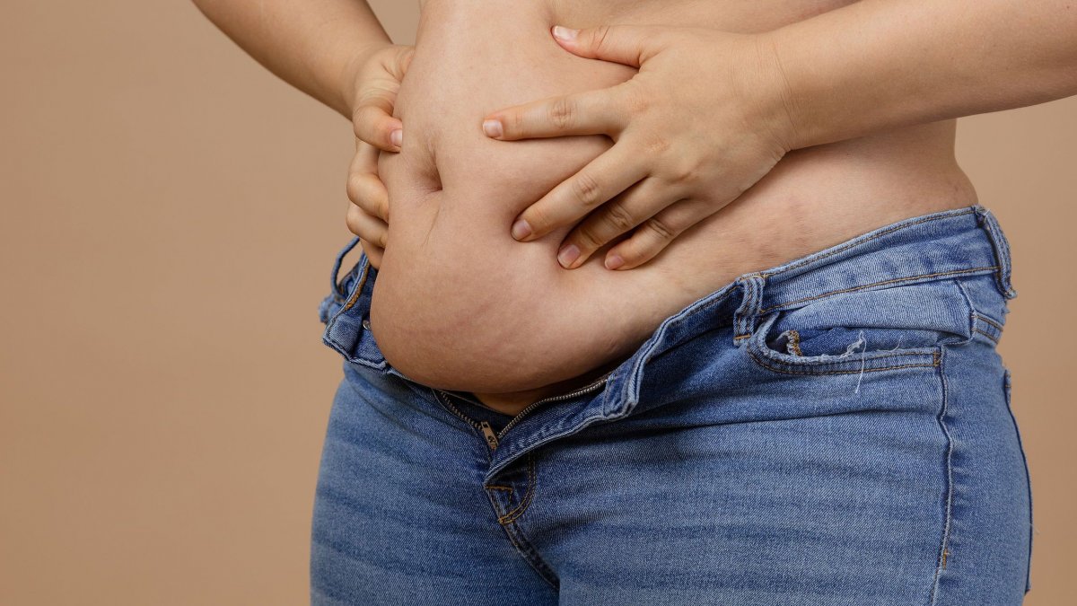 Λίπος στην κοιλιά: Πέντε συνήθειες που επιδεινώνουν την κατάσταση