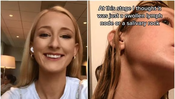 ΗΠΑ: Γυναίκα ανακάλυψε ότι πάσχει από καρκίνο μέσα από ένα viral Tik Τok trend (βίντεο)