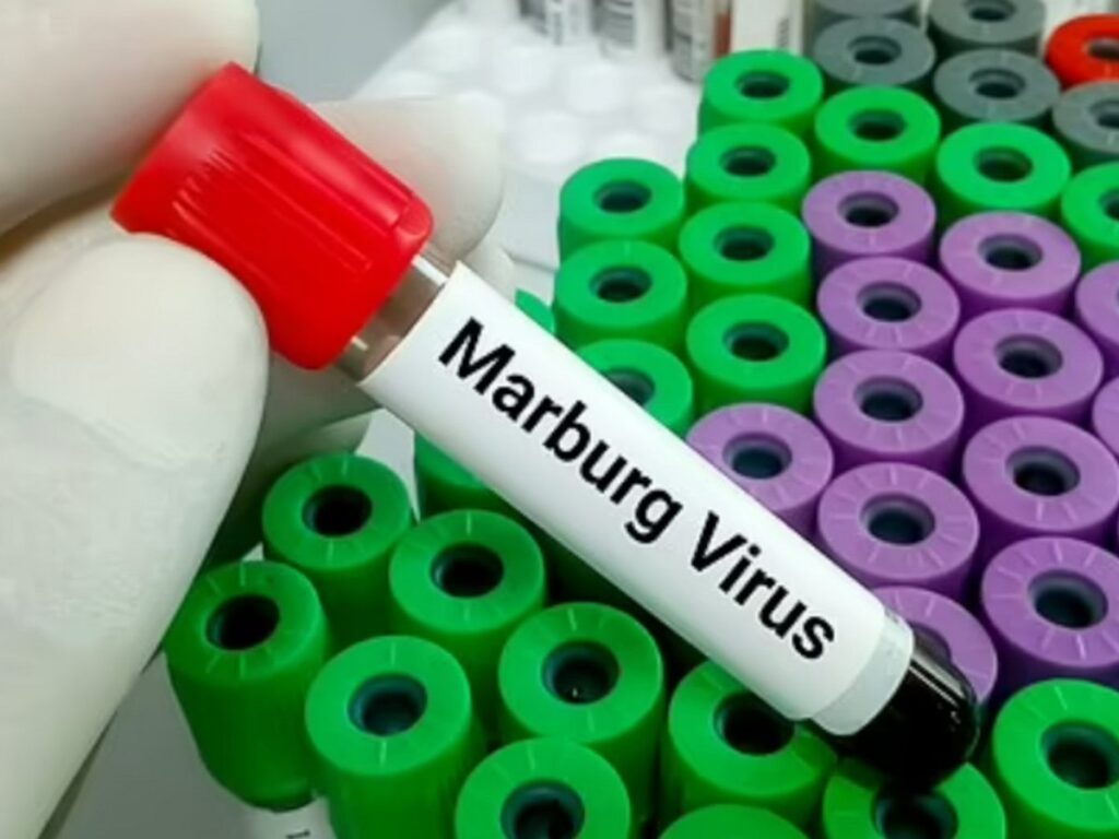 Αιμορραγικός πυρετός Marburg: Ο νέος θανατηφόρος ιός που σκοτώνει εννιά στους δέκα ασθενείς