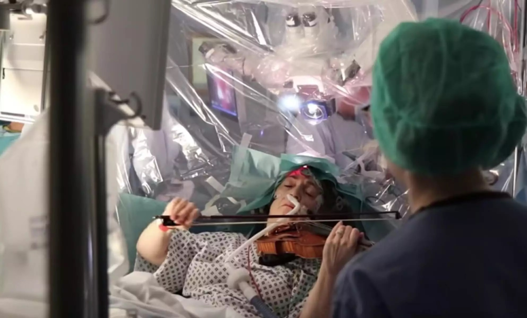 Έχει γίνει viral: Γυναίκα παίζει βιολί ενώ της αφαιρούν όγκο από τον εγκέφαλο (βίντεο)