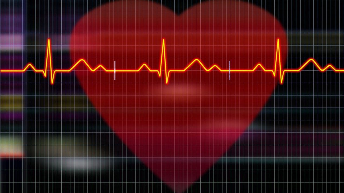 Τι είναι ο ακανόνιστος καρδιακός παλμός και πώς αντιμετωπίζεται;