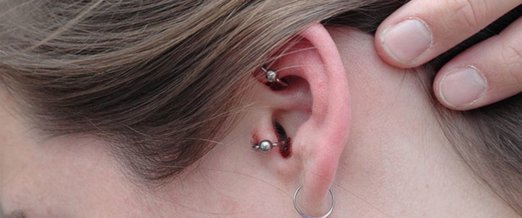Κοιμάσαι φορώντας σκουλαρίκια; – Να τι μπορεί να συμβεί στο δέρμα σου