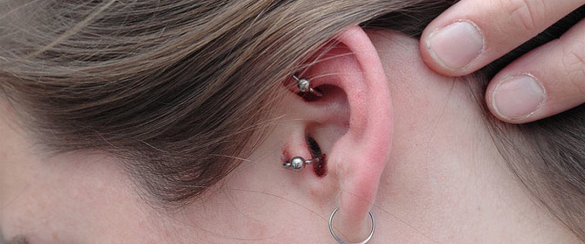 Κοιμάσαι φορώντας σκουλαρίκια; – Να τι μπορεί να συμβεί στο δέρμα σου