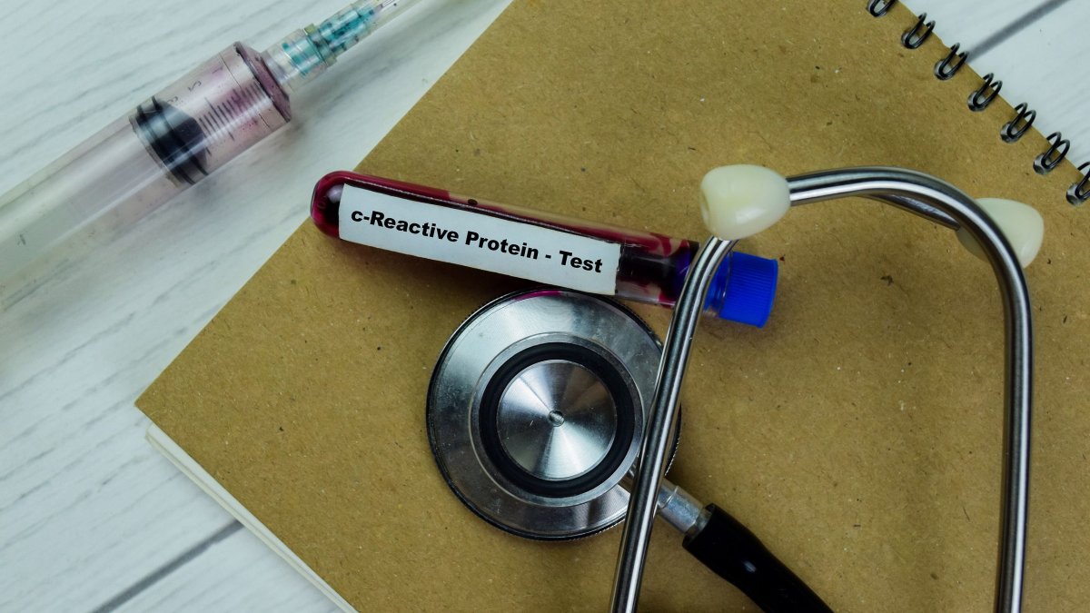 Κατάθλιψη: Ερευνητές ανακάλυψαν πρωτεΐνη στο αίμα που ίσως την καταπολεμάει