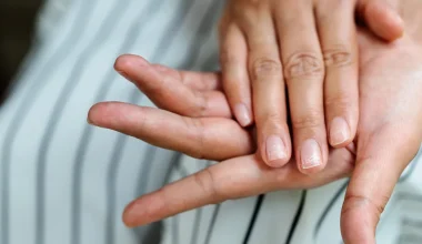 Eggshell Nails: Μήπως τα νύχια σου πάσχουν από αυτό το πρόβλημα χωρίς να το γνωρίζεις;
