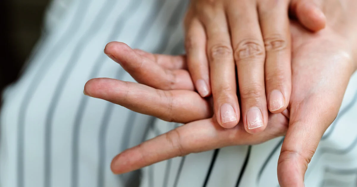 Eggshell Nails: Μήπως τα νύχια σου πάσχουν από αυτό το πρόβλημα χωρίς να το γνωρίζεις;
