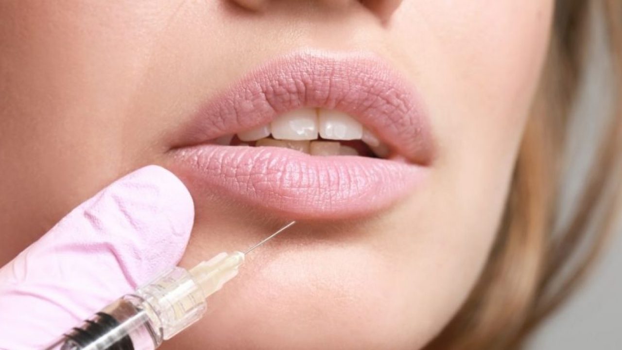 Fillers στα χείλη: Ο κίνδυνος που μπορεί να αντιμετωπίσετε