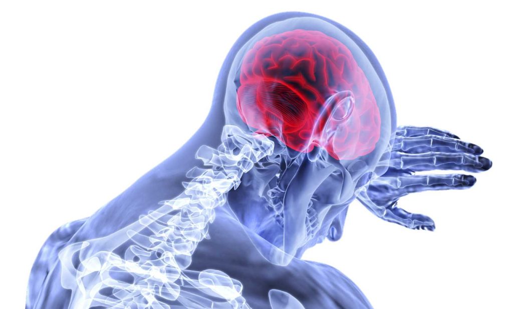 Αυτά είναι τα 6 άγνωστα σημάδια εγκεφαλικού επεισοδίου – Ποιες οι αιτίες