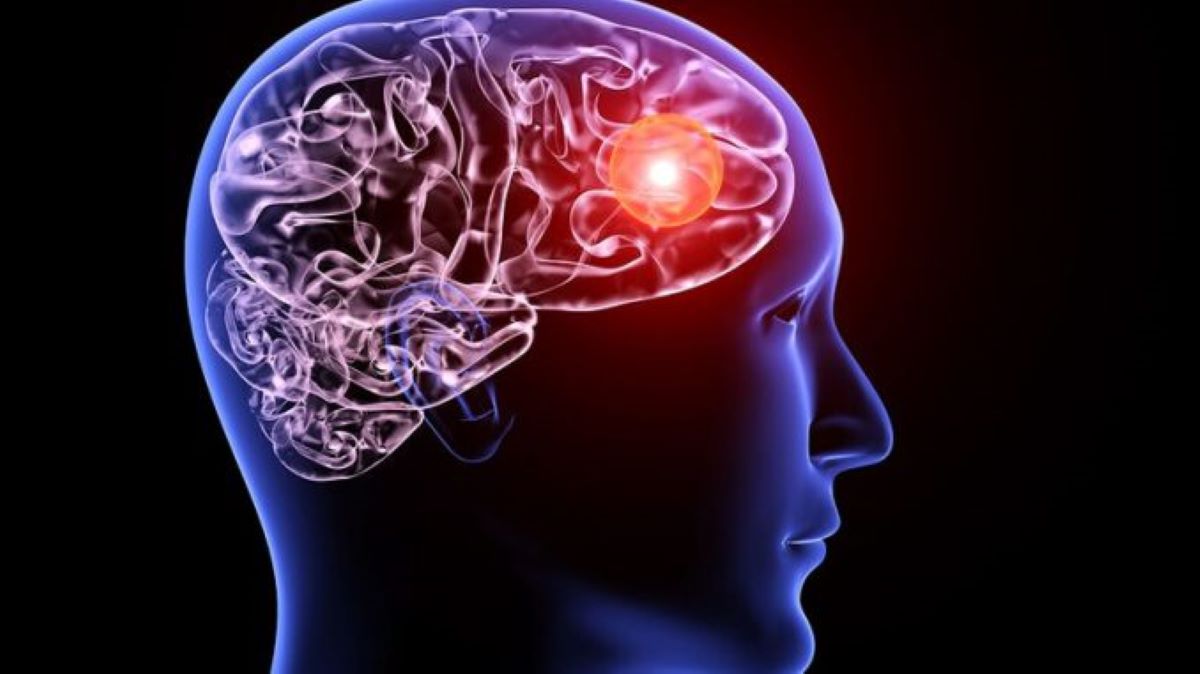 Ανεύρυσμα εγκεφάλου: Δείτε ποια είναι τα συμπτώματα που δεν πρέπει να αγνοήσετε
