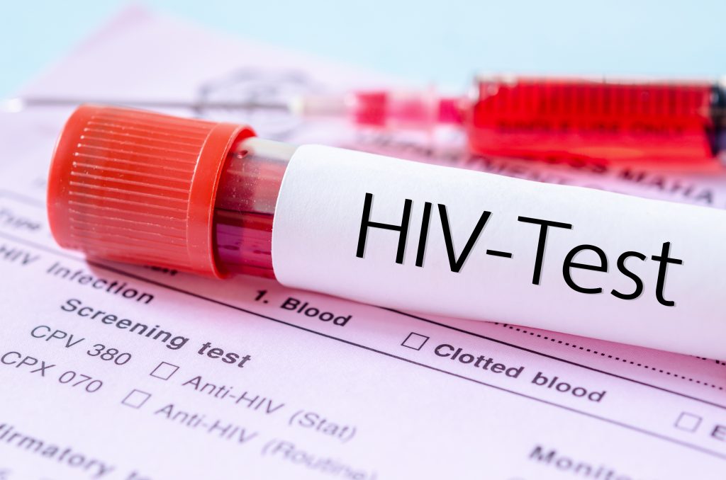 Ιταλία: Δωρεάν για τις γυναίκες η προληπτική θεραπεία που μειώνει τις πιθανότητες μόλυνσης με τον ιό HIV