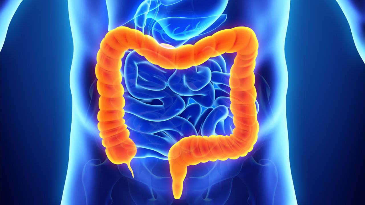 Καρκίνος του παχέος εντέρου: Αυτά είναι τα συμπτώματα – Πώς μπορώ να τον προλάβω;