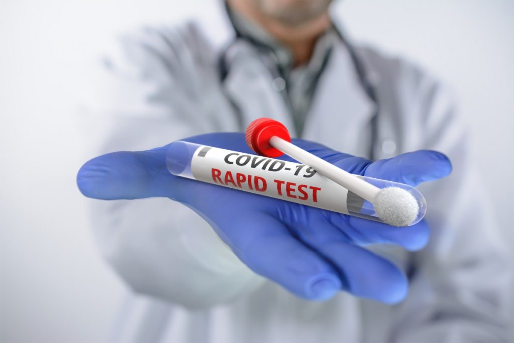 Διαγνωστικά κέντρα σε Θ.Πλεύρη: «Να σταματήσουν τα rapid test από τα ιδιωτικά φαρμακεία»