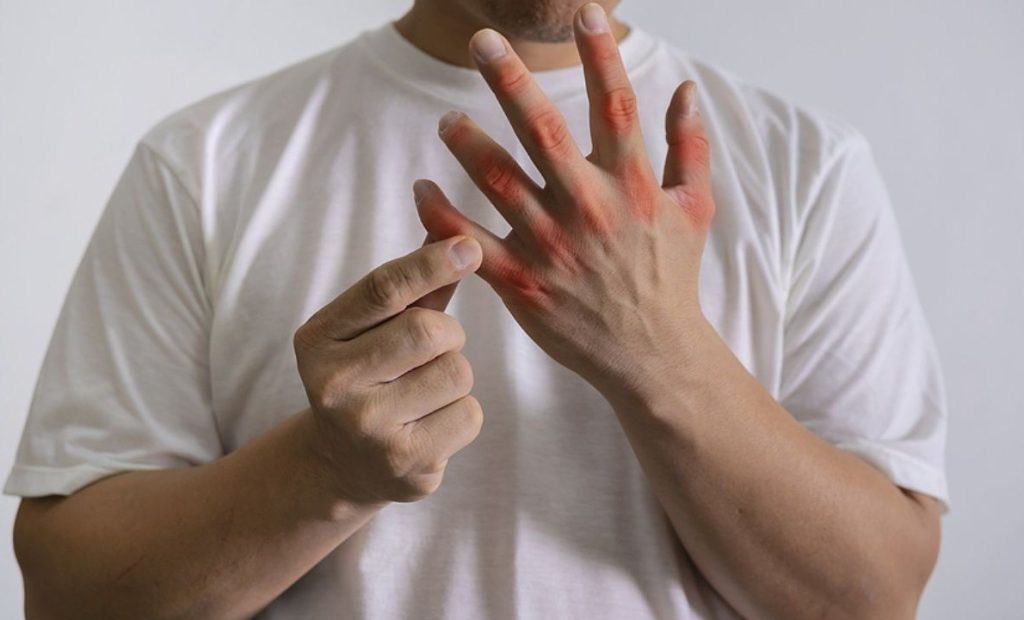 Αυτά είναι τα συμπτώματα της ουρικής αρθρίτιδας – Ποιες αρθρώσεις μπορεί να προσβληθούν